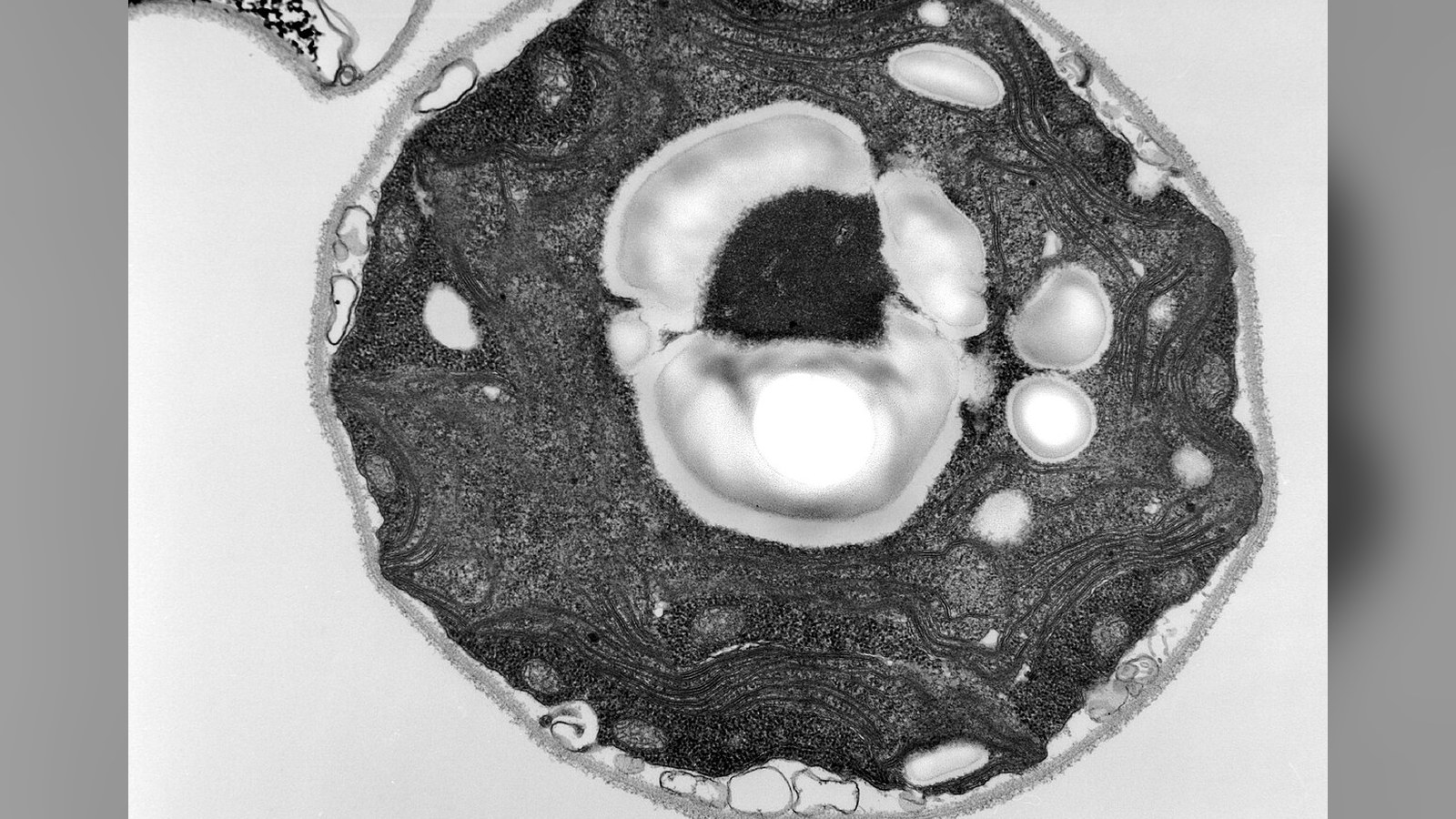 Nobel de médecine : l'optogénétique, ou l'art de piloter les neurones avec la lumière
