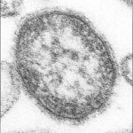 Rougeole : la Pennsylvanie enregistre un sixième décès, une femme non vaccinée de 39 ans