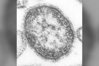 Rougeole : la Pennsylvanie enregistre un sixième décès, une femme non vaccinée de 39 ans